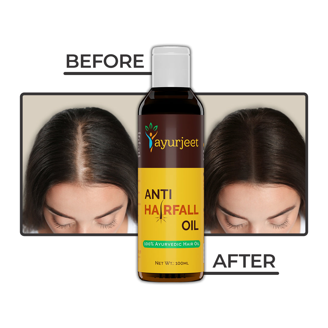 Anti Hairfall Oil is specially Formulated with Natural Ingredients that Nourish and Strengthen hair from the Roots to the tips.